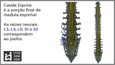 cauda-equina-e-dor-no-joelho-vivasemdor