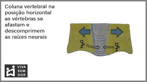 coluna-vertebral-na-posicao-horizontal-e-a-dor-no-joelho-vivasemdor