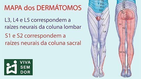 dermatomos-do-nervo-ciatico-vivasemdor