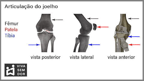 dor-no-joelho-imagem-da-articulacao-vivasemdor